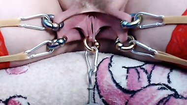 Stretching of the labia majora (2 kg) and the labia minora (200g)